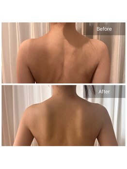 メゾン ド サファリ(maison de Safari)/プレ花嫁さまのご来店 B/A