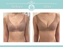 美人バスト 赤羽店/バストアップ・バストケア症例★