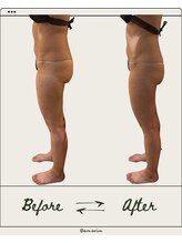 ドゥ ドルチェ(Due dolce)/お腹が半分に！？　1度の施術