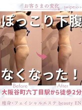 ビューティエン(beauty EN)/痩身ダイエットマッサージエステ