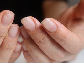 自爪風/柳津ネイルサロン