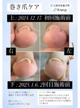 ダイヤモンドボディ/巻き爪ケア