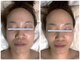 コニワ(528hz)の写真