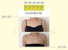 リー(Riy)/《Before and After》