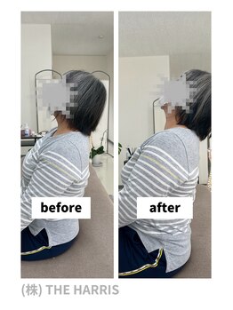 由利本荘整体院/施術ビフォーアフター（首）