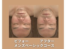 アオイスター(AOIstar)/メンズフェイシャル