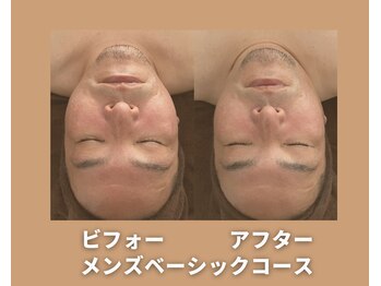 アオイスター(AOIstar)/メンズフェイシャル