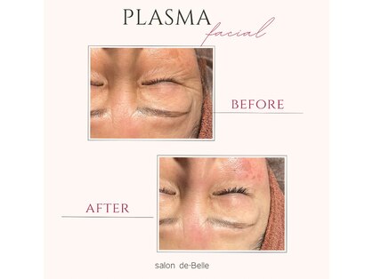 サロンドベル(salon de Belle)の写真