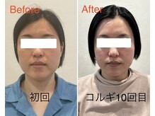 ビーキュート 姫路店(BE-CUTE)/小顔コルギ10回目