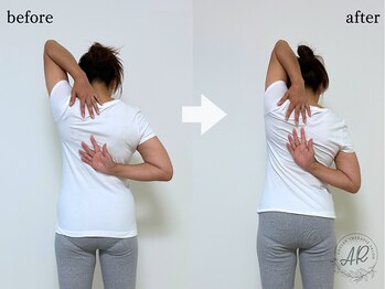 エーアール(AR)/【Before/After】