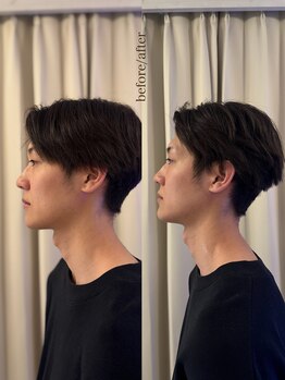 アルテ 神戸(Arte)/