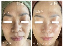 ルミエール フォレストサイド(L’MIERE forestside)の雰囲気（骨格に合わせ筋肉ケア！気になるシワに◎定期的な施術でキープ）