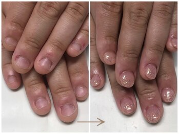 ブルームーンネイルズ(BLOOMOON.nails)の写真/【ネイルサロンが初めてで不安な方へ☆深爪・爪かみのお悩みもお気軽にご相談ください】