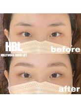 ジョリレーヌ(Jolie Reine)/ハリウッドブロウリフト