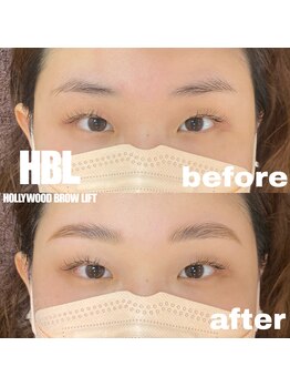 ジョリレーヌ(Jolie Reine)/ハリウッドブロウリフト