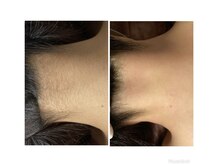 マイレ 銀座(MAILE)/うなじ