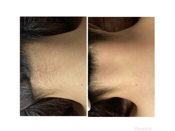 マイレ 銀座(MAILE)/うなじ