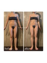 ボーレーヴ 表参道店(beaureve)/施術効果写真（before after）