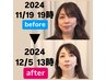 □■人気No. 1■□ お顔の余白が変わる立体感フェイシャル　42000→