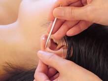 リュウ鍼灸院 サロン ド リュウ(Salon de Ryu)/リフトアップの持続に耳鍼