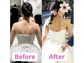 ボディキュア ブライダル美容整体 大阪梅田/隙のない美しさに★/関西/梅田