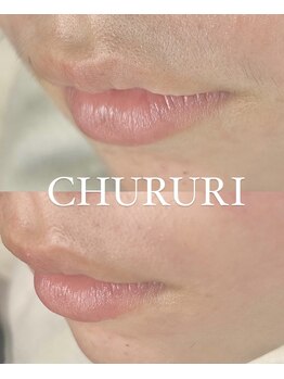 チュルリ 新町店(Chururi)/フェイスワックス/顔脱毛