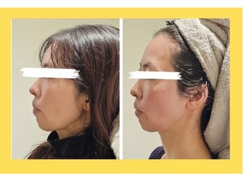 アン 銀座(ann)/レモンボトル