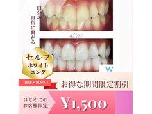 ホワイトニングショップ 町田店