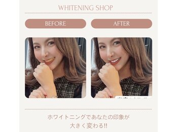 ホワイトニングショップ 葵区静岡駅店/ホワイトニング店ホワイトニング