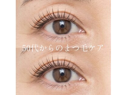 マックス(MAX)の写真