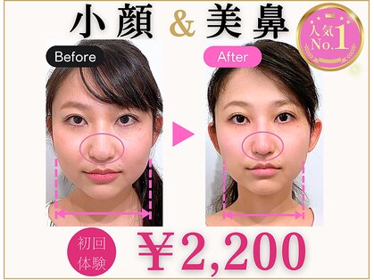 ラプリ 福岡天神店(Raplit)の写真