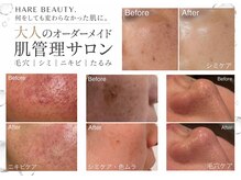 ハレビューティー 北千住(HARE BEAUTY.)