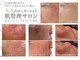 ハレビューティー 北千住(HARE BEAUTY.)の写真
