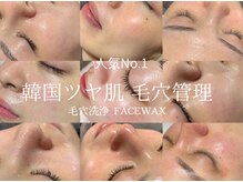 エトレ(ETOLE)