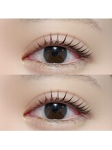 センスオブビューティー 東新宿店(SENSE OF BEAUTY)/パッチリデザイン