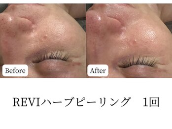 マテオ(Matteo)/陶器肌へ