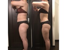 クイーンズ ピュア 長崎店(Queen's Pure)/強力痩身インドマッサージ