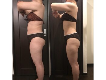 クイーンズ ピュア 長崎店(Queen's Pure)/強力痩身インドマッサージ