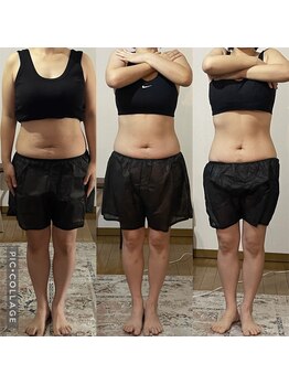 しあわせ腸研究所/腸もみbefore & after