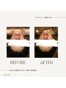 グランツ 小山店/インディバフェイシャル60分
