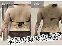 ノンノンプラス 博多(NON-NONプラス)