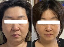 ペリドット(Peridot)/