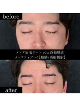 ユー 西船橋店(you)/ビフォーアフターお写真