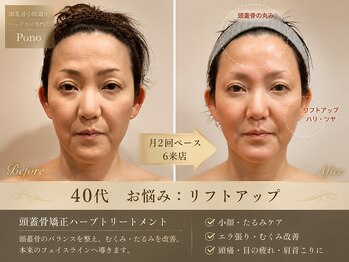 ポノ 甲府本店(pono)/頭蓋骨矯正ハーブトリートメント