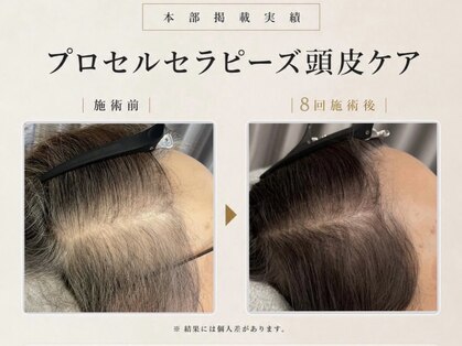 リードスラッシュ(LEAD/)の写真