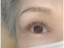 ビオエル(BIOEL)/