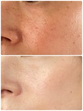 美顔研究所 バイ ヴィヴセカンド(美顔研究所 by viv 2nd)/