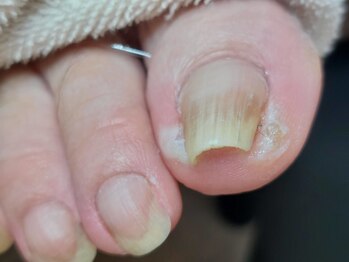 爪切り屋 足楽/ホームケアの基本