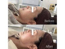 ラ フルール(La Fleur)/カーボキシートリートメント