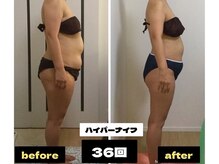 《ハイパーシリーズ》ナイフとシェイプでお身体の変化即実感！